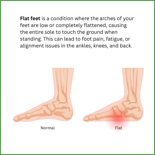 Flat feet
