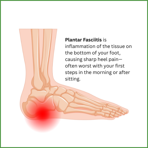 Plantar Fasciitis